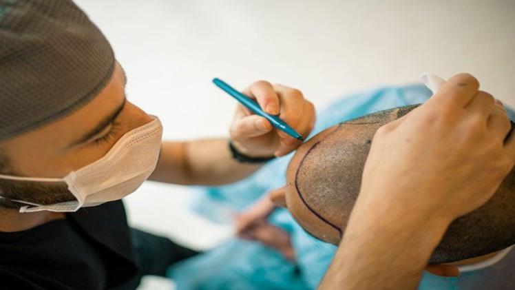 Hair Transplant In Albania: Is It A Wise Decision?